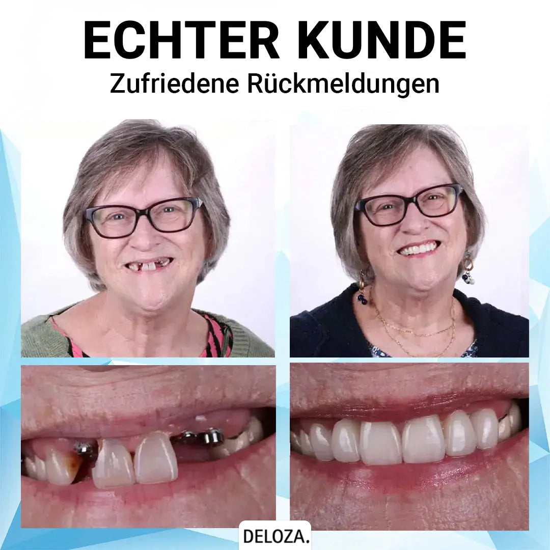 Flexibler Zahnersatz aus Silikon - Kosmetische Zahnprothese