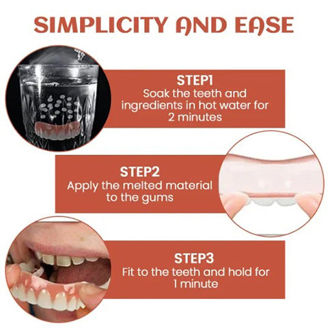 Orvelia | Soft Silicone Denture Reline Kit, Fitted at Home for Upper or Lower Plates