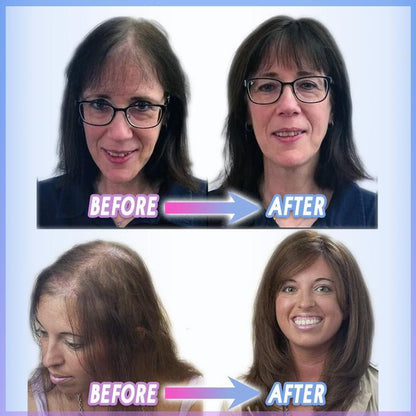 Toppina | Postizo con clip para la coronilla de cabello sintético, 22 cm