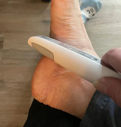 Pedivra | Elektrischer Hornhautentferner mit 3 Stufen, USB-Akku und 360° Walze
