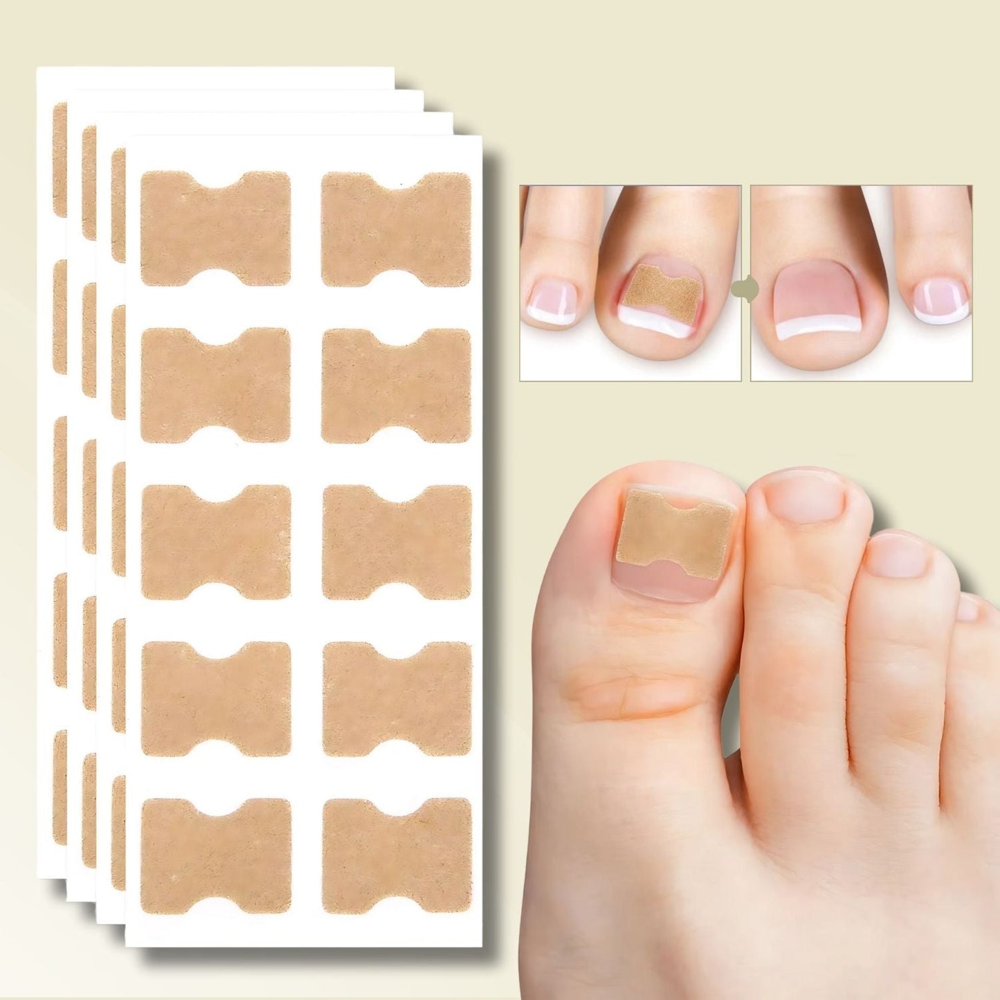 FixaNail | Innovatives Nagelkorrektursystem für gesunde Nägel 0