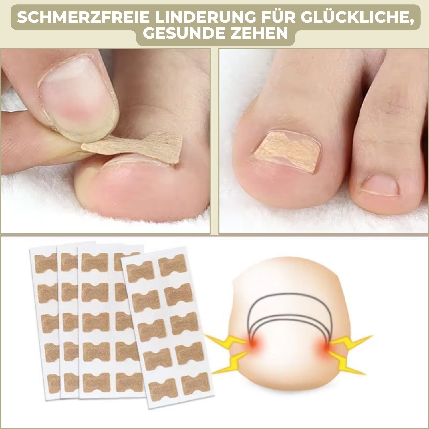 FixaNail | Innovatives Nagelkorrektursystem für gesunde Nägel 2