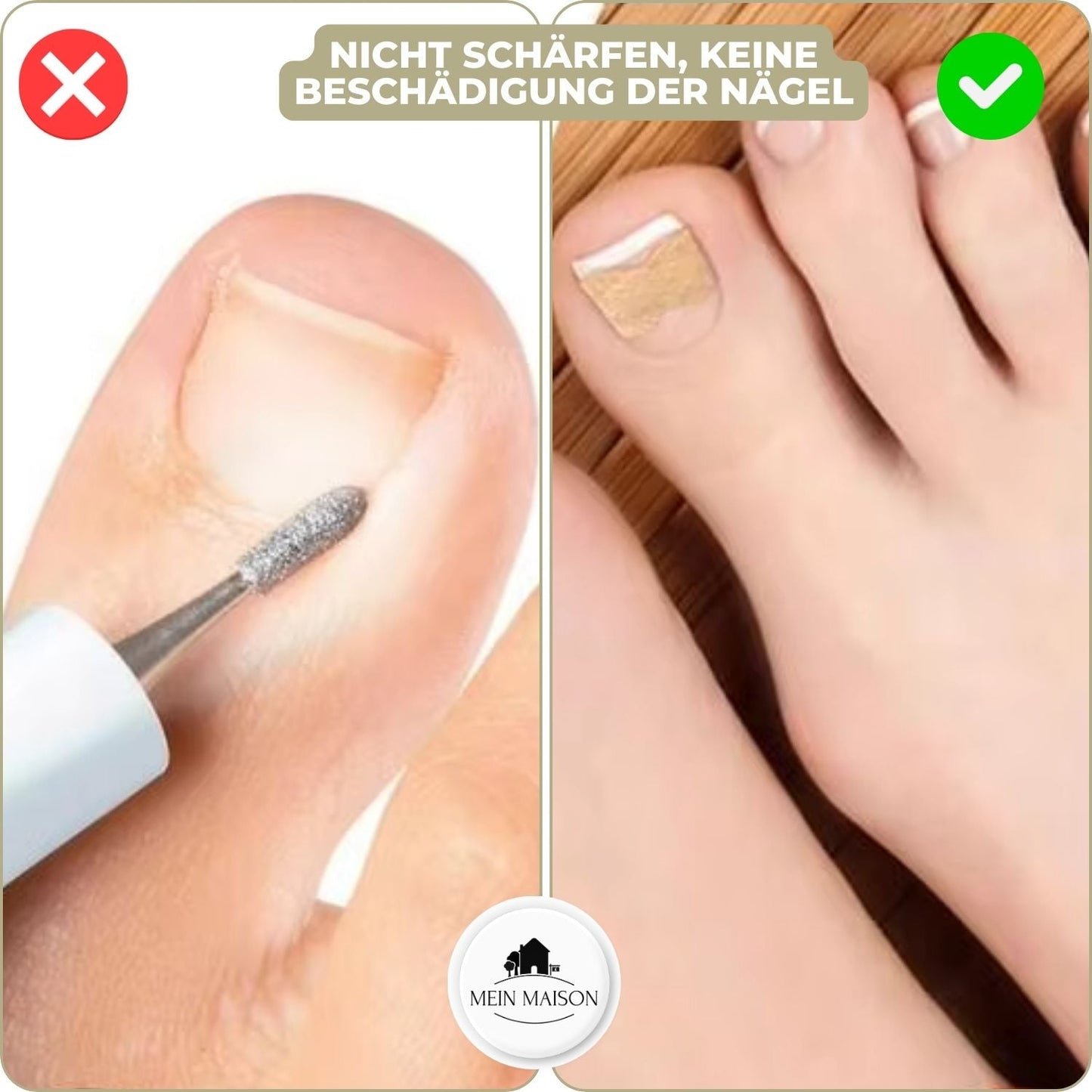 FixaNail | Innovatives Nagelkorrektursystem für gesunde Nägel 4