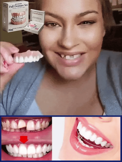 Smilvea | Set dental cosmético superior e inferior, moldeable en agua caliente