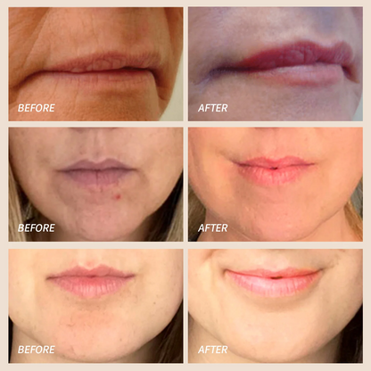 Luminara | LED-Lippenvolumizer 3
