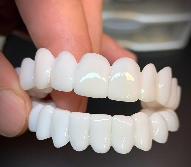 Lumineux | Natürliche Zahnprothese für Elegantes Lächeln 1