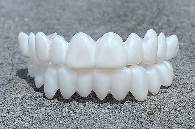 Lumineux | Natürliche Zahnprothese für Elegantes Lächeln 2