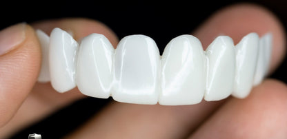 Lumineux | Natürliche Zahnprothese für Elegantes Lächeln 3