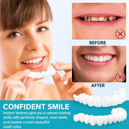 Smilvia | Carillas dentales removibles para los dientes superiores e inferiores, reutilizables