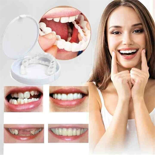 Smilvia | Carillas dentales removibles para los dientes superiores e inferiores, reutilizables