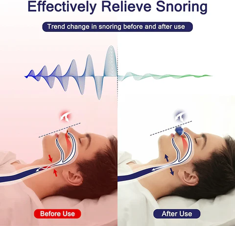 SnoozeAir | Tragbares Schlafunterstützungsgerät 3
