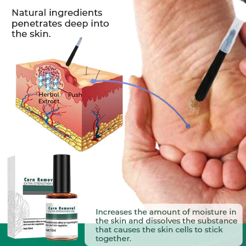 Solvari | Gel per la cura dei piedi contro i calli con beccuccio dosatore fine, 2 pezzi