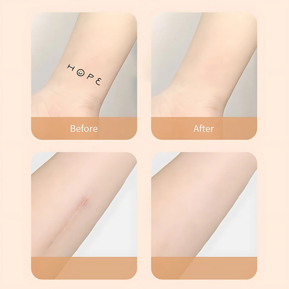 Camuva | Parches cubre cicatrices y tatuajes, resistentes al agua | 6 unidades